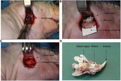 Repair of a Rat Mandibular Bone Defect by Hypertrophic Cartilage Grafts Engineered From Human Fractionated Adipose Tissue